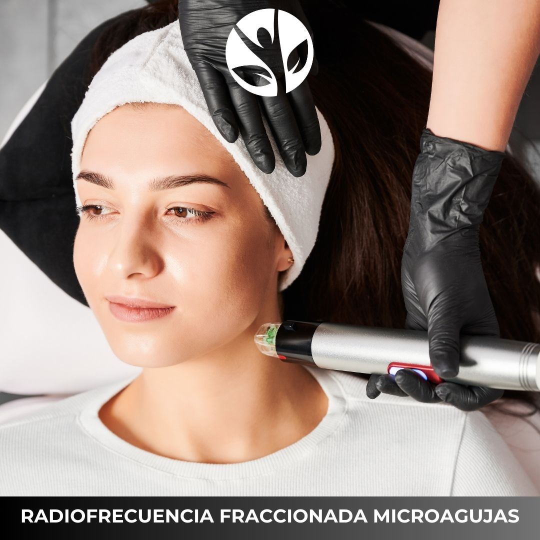 RADIOFRECUENCIA FRACCIONADA CON MICROAGUJAS