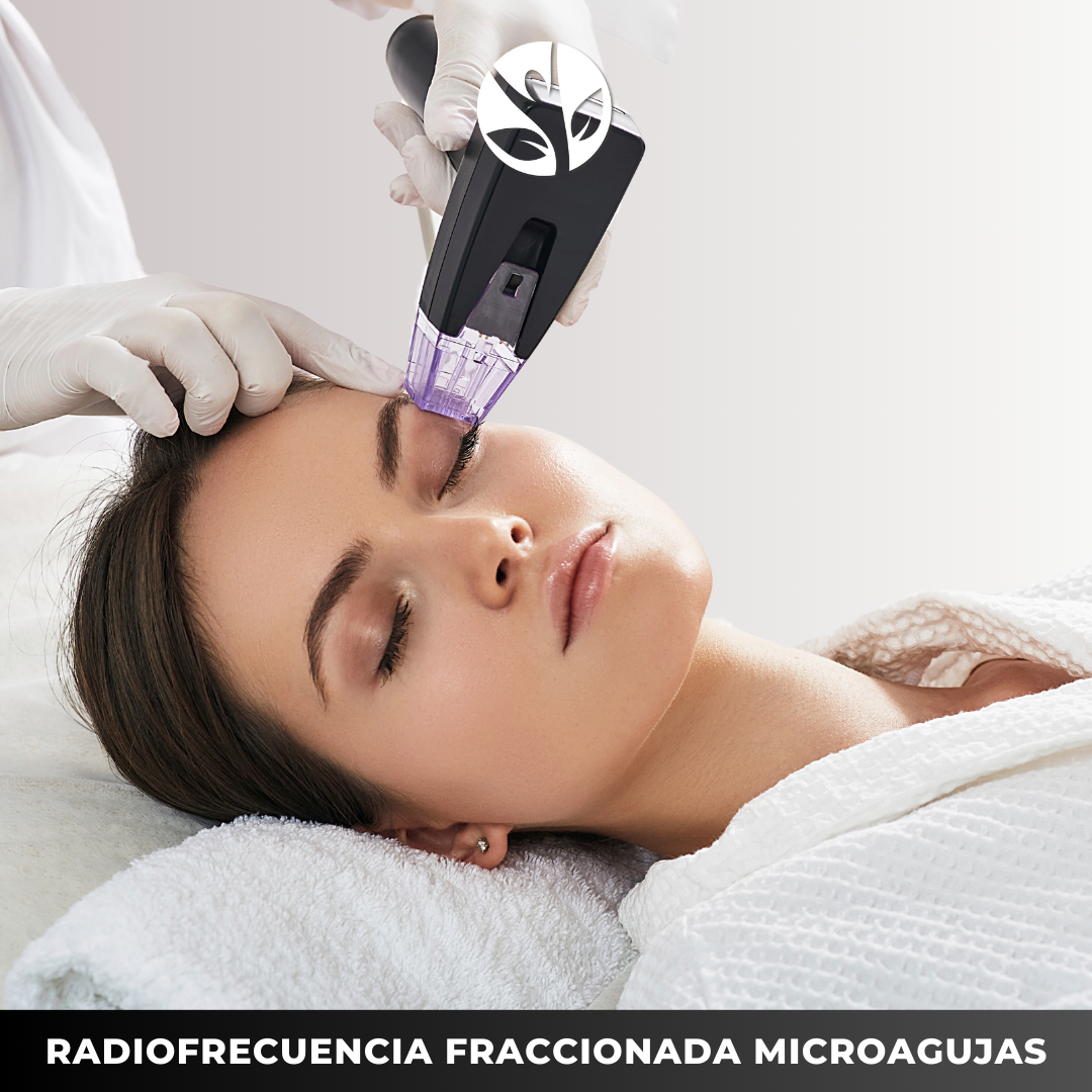 RADIOFRECUENCIA FRACCIONADA CON MICROAGUJAS